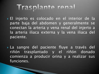    El injerto es colocado en el interior de la
    parte baja del abdomen y generalmente se
    conectan la arteria y vena renal del injerto a
    la arteria iliaca externa y la vena iliaca del
    paciente.

   La sangre del paciente fluye a través del
    riñón trasplantado y el riñón donado
    comienza a producir orina y a realizar sus
    funciones.
 