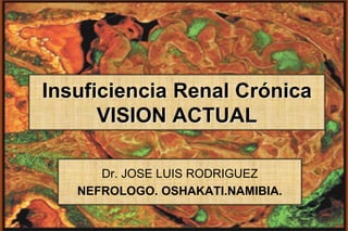 Insuficiencia Renal Crónica
VISION ACTUAL
Dr. JOSE LUIS RODRIGUEZ
NEFROLOGO. OSHAKATI.NAMIBIA.
 