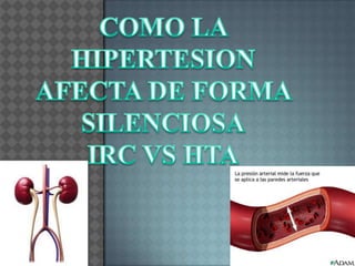 COMO LA HIPERTESION  AFECTA DE FORMA  SILENCIOSA IRC VS HTA 