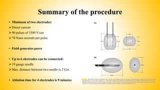 Summary of the procedure
• Minimum of two electrodes:
Direct current
90 pulses of 1500 V/cm
70 Nano seconds per pulse
• Field generates pores
• Up to 6 electrodes can be connected:
19 gauge needle
Max. distance between two needle is 2 Cm
• Ablation time for 4 electrodes is 9 minutes
 