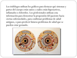 Los iridólogos utilizan los gráficos para destacar qué sistemas y partes del cuerpo están sanos y cuáles están hiperactivos, inflamados o doloridos. Los profesionales utilizan esta información para demostrar la propensión del paciente hacia ciertas enfermedades, para confirmar problemas de salud antiguos, o para predecir futuros problemas de salud que se pueden estar gestando. 