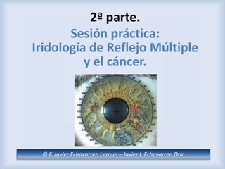 © F. Javier Echavarren Lezaun – Javier I. Echavarren Otín
2ª parte.
Sesión práctica:
Iridología de Reflejo Múltiple
y el cáncer.
1
 