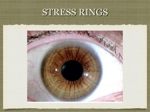 Iridology