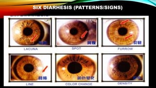 SIX DIARHESIS (PATTERNS/SIGNS)
 