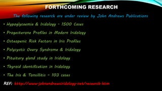 FORTHCOMING RESEARCH
The following research are under review by John Andrews Publications
• Hypoglycaemia & Iridology - 1500 Cases
• Progesterone Profiles in Modern Iridology
• Osteopenic Risk Factors in Iris Profiles
• Polycystic Ovary Syndrome & Iridology
• Pituitary gland study in Iridology
• Thyroid identification in Iridology
• The Iris & Tonsillitis – 103 cases
REF: http://www.johnandrewsiridology.net/research.htm
 