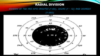 RADIAL DIVISION
DIVISION OF THE IRIS INTO MINUTES (1-60), HOURS (1 - 12) AND DEGREES
(1-360)
 