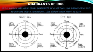 QUADRANTS OF IRIS
IRIS IS DIVIDED INTO FOUR EQUAL QUADRANTS BY A VERTICAL LINE DRAWN FROM TOP
TO BOTTOM, AND A HORIZONTAL LINE DRAWN FROM RIGHT TO LEFT
 