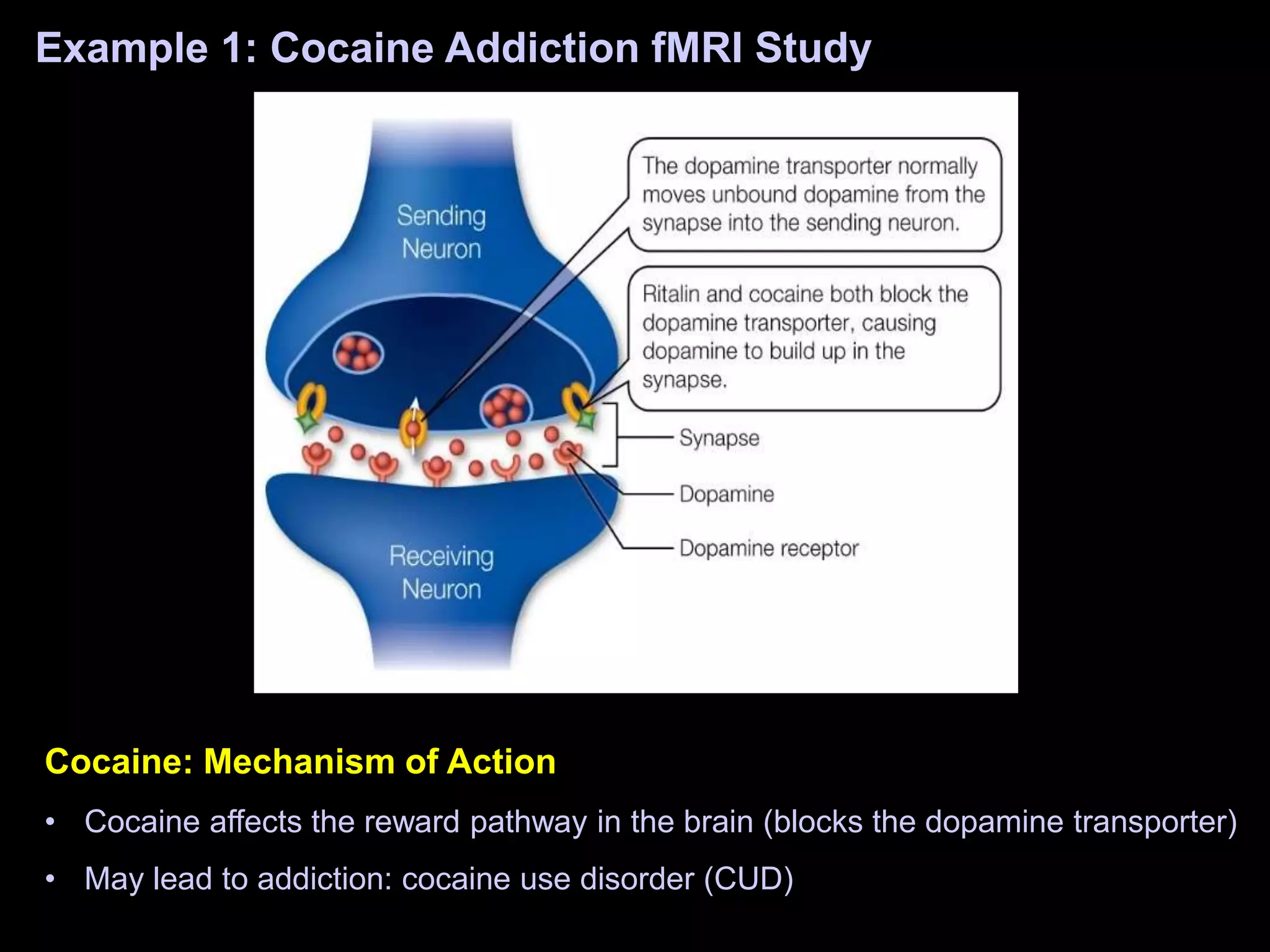 Example 1: Cocaine Addiction fMRI Study
Cocaine: Mechanism of Action
• Cocaine affects the reward pathway in the brain (blocks the dopamine transporter)
• May lead to addiction: cocaine use disorder (CUD)
 
