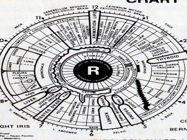 IRIS CHART.pptx iris chart of eyes in human | PPTX | Eye and Vision ...