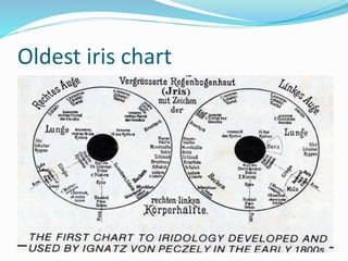 IRIS CHART.pptx iris chart of eyes in human | PPTX