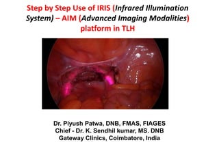 Step by Step Use of IRIS (Infrared Illumination
System) – AIM (Advanced Imaging Modalities)
platform in TLH
Dr. Piyush Patwa, DNB, FMAS, FIAGES
Chief - Dr. K. Sendhil kumar, MS. DNB
Gateway Clinics, Coimbatore, India
 