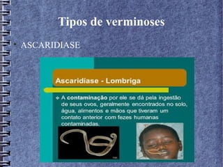 Tipos de verminoses 
 ASCARIDIASE 
 