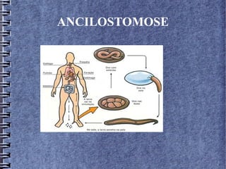 ANCILOSTOMOSE 
