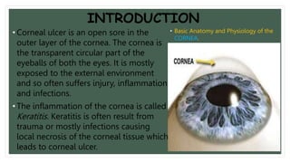 INTRODUCTION
• Corneal ulcer is an open sore in the
outer layer of the cornea. The cornea is
the transparent circular part of the
eyeballs of both the eyes. It is mostly
exposed to the external environment
and so often suffers injury, inflammation
and infections.
• The inflammation of the cornea is called
Keratitis. Keratitis is often result from
trauma or mostly infections causing
local necrosis of the corneal tissue which
leads to corneal ulcer.
• Basic Anatomy and Physiology of the
CORNEA.
 