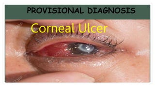 PROVISIONAL DIAGNOSIS
• Corneal Ulcer
 