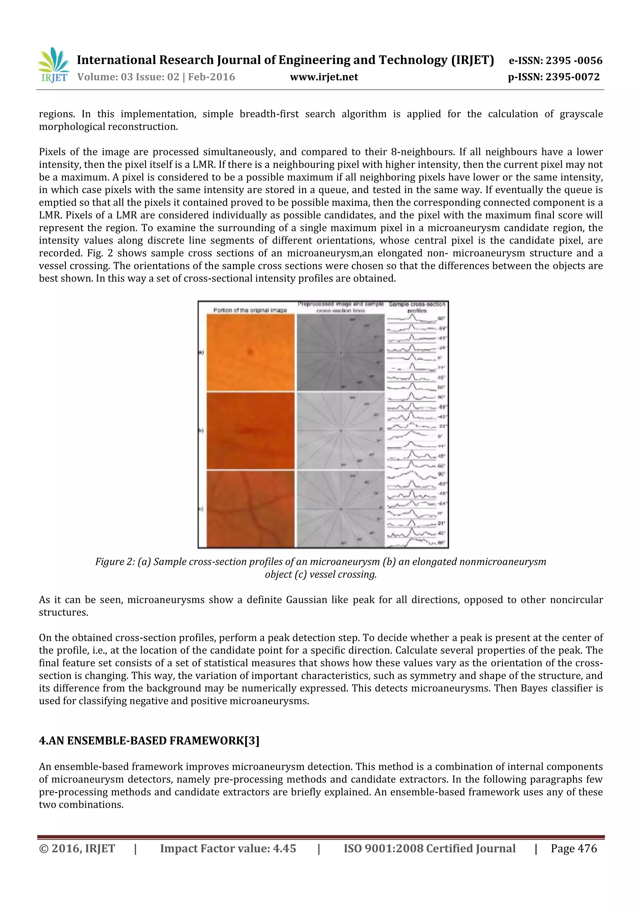 International Research Journal of Engineering and Technology (IRJET) e-ISSN: 2395 -0056
Volume: 03 Issue: 02 | Feb-2016 www.irjet.net p-ISSN: 2395-0072
© 2016, IRJET | Impact Factor value: 4.45 | ISO 9001:2008 Certified Journal | Page 476
regions. In this implementation, simple breadth-first search algorithm is applied for the calculation of grayscale
morphological reconstruction.
Pixels of the image are processed simultaneously, and compared to their 8-neighbours. If all neighbours have a lower
intensity, then the pixel itself is a LMR. If there is a neighbouring pixel with higher intensity, then the current pixel may not
be a maximum. A pixel is considered to be a possible maximum if all neighboring pixels have lower or the same intensity,
in which case pixels with the same intensity are stored in a queue, and tested in the same way. If eventually the queue is
emptied so that all the pixels it contained proved to be possible maxima, then the corresponding connected component is a
LMR. Pixels of a LMR are considered individually as possible candidates, and the pixel with the maximum final score will
represent the region. To examine the surrounding of a single maximum pixel in a microaneurysm candidate region, the
intensity values along discrete line segments of different orientations, whose central pixel is the candidate pixel, are
recorded. Fig. 2 shows sample cross sections of an microaneurysm,an elongated non- microaneurysm structure and a
vessel crossing. The orientations of the sample cross sections were chosen so that the differences between the objects are
best shown. In this way a set of cross-sectional intensity profiles are obtained.
Figure 2: (a) Sample cross-section profiles of an microaneurysm (b) an elongated nonmicroaneurysm
object (c) vessel crossing.
As it can be seen, microaneurysms show a definite Gaussian like peak for all directions, opposed to other noncircular
structures.
On the obtained cross-section profiles, perform a peak detection step. To decide whether a peak is present at the center of
the profile, i.e., at the location of the candidate point for a specific direction. Calculate several properties of the peak. The
final feature set consists of a set of statistical measures that shows how these values vary as the orientation of the cross-
section is changing. This way, the variation of important characteristics, such as symmetry and shape of the structure, and
its difference from the background may be numerically expressed. This detects microaneurysms. Then Bayes classifier is
used for classifying negative and positive microaneurysms.
4.AN ENSEMBLE-BASED FRAMEWORK[3]
An ensemble-based framework improves microaneurysm detection. This method is a combination of internal components
of microaneurysm detectors, namely pre-processing methods and candidate extractors. In the following paragraphs few
pre-processing methods and candidate extractors are briefly explained. An ensemble-based framework uses any of these
two combinations.
 