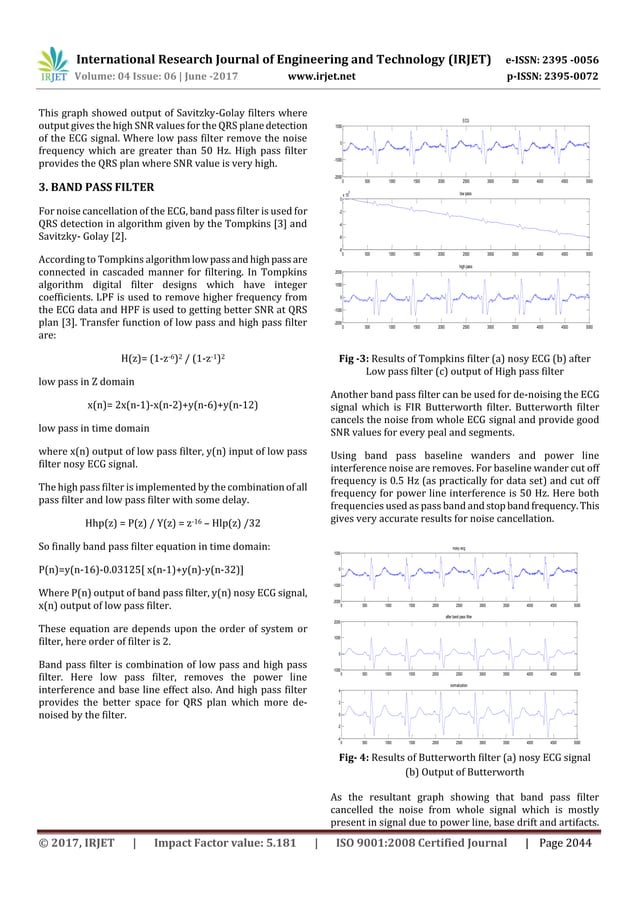 ECG Signal Denoising using Digital Filter and Adaptive Filter | PDF