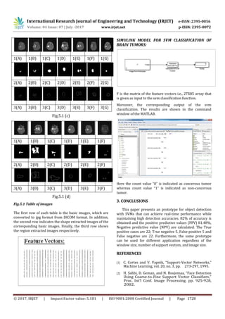 International Research Journal of Engineering and Technology (IRJET) e-ISSN: 2395-0056
Volume: 04 Issue: 07 | July -2017 www.irjet.net p-ISSN: 2395-0072
© 2017, IRJET | Impact Factor value: 5.181 | ISO 9001:2008 Certified Journal | Page 1728
1(A) 1(B) 1(C) 1(D) 1(E) 1(F) 1(G)
2(A) 2(B) 2(C) 2(D) 2(E) 2(F) 2(G)
3(A) 3(B) 3(C) 3(D) 3(E) 3(F) 3(G)
Fig.5.1 (c)
1(A) 1(B) 1(C) 1(D) 1(E) 1(F)
2(A) 2(B) 2(C) 2(D) 2(E) 2(F)
3(A) 3(B) 3(C) 3(D) 3(E) 3(F)
Fig.5.1 (d)
Fig.5.1 Table of images
The first row of each table is the basic images, which are
converted to jpg format from DICOM format. In addition,
the second row indicates the shape extracted images of the
corresponding basic images. Finally, the third row shows
the region extracted images respectively.
SIMULINK MODEL FOR SVM CLASSIFICATION OF
BRAIN TUMORS:
F is the matrix of the feature vectors i.e., 27X85 array that
is given as input to the svm classification function.
Moreover, the corresponding output of the svm
classification. The results are shown in the command
window of the MATLAB.
Here the count value “0” is indicated as cancerous tumor
whereas count value “1” is indicated as non-cancerous
tumor.
3. CONCLUSIONS
This paper presents an prototype for object detection
with SVMs that can achieve real-time performance while
maintaining high detection accuracies. 82% of accuracy is
obtained and the positive predictive values (PPV) 81.48%,
Negative predictive value (NPV) are calculated. The True
positive cases are 22; True negative 5, False positive 5 and
False negative are 22. Furthermore, the same prototype
can be used for different application regardless of the
window size, number of support vectors, and image size.
REFERENCES
[1] C. Cortes and V. Vapnik, “Support-Vector Networks,”
Machine Learning, vol. 20, no. 3, pp. 273-297, 1995.
[2] H. Sahbi, D. Geman, and N. Boujemaa, “Face Detection
Using Coarse-to-Fine Support Vector Classifiers,”
Proc. Int’l Conf. Image Processing, pp. 925-928,
2002.
 