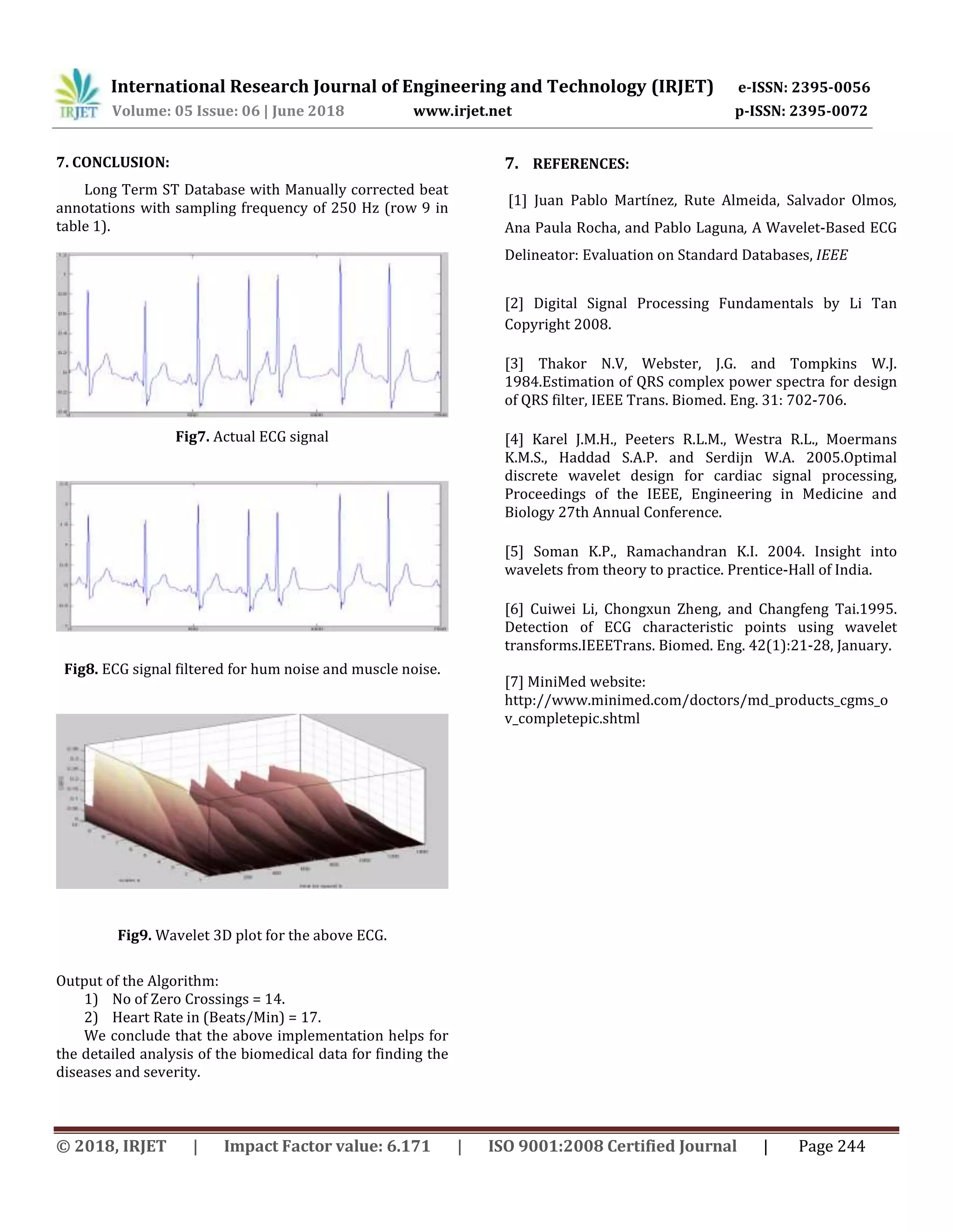 International Research Journal of Engineering and Technology (IRJET) e-ISSN: 2395-0056
Volume: 05 Issue: 06 | June 2018 www.irjet.net p-ISSN: 2395-0072
© 2018, IRJET | Impact Factor value: 6.171 | ISO 9001:2008 Certified Journal | Page 244
7. CONCLUSION:
Long Term ST Database with Manually corrected beat
annotations with sampling frequency of 250 Hz (row 9 in
table 1).
Fig7. Actual ECG signal
Fig8. ECG signal filtered for hum noise and muscle noise.
Fig9. Wavelet 3D plot for the above ECG.
Output of the Algorithm:
1) No of Zero Crossings = 14.
2) Heart Rate in (Beats/Min) = 17.
We conclude that the above implementation helps for
the detailed analysis of the biomedical data for finding the
diseases and severity.
7. REFERENCES:
[1] Juan Pablo Martínez, Rute Almeida, Salvador Olmos,
Ana Paula Rocha, and Pablo Laguna, A Wavelet-Based ECG
Delineator: Evaluation on Standard Databases, IEEE
[2] Digital Signal Processing Fundamentals by Li Tan
Copyright 2008.
[3] Thakor N.V, Webster, J.G. and Tompkins W.J.
1984.Estimation of QRS complex power spectra for design
of QRS filter, IEEE Trans. Biomed. Eng. 31: 702-706.
[4] Karel J.M.H., Peeters R.L.M., Westra R.L., Moermans
K.M.S., Haddad S.A.P. and Serdijn W.A. 2005.Optimal
discrete wavelet design for cardiac signal processing,
Proceedings of the IEEE, Engineering in Medicine and
Biology 27th Annual Conference.
[5] Soman K.P., Ramachandran K.I. 2004. Insight into
wavelets from theory to practice. Prentice-Hall of India.
[6] Cuiwei Li, Chongxun Zheng, and Changfeng Tai.1995.
Detection of ECG characteristic points using wavelet
transforms.IEEETrans. Biomed. Eng. 42(1):21-28, January.
[7] MiniMed website:
http://www.minimed.com/doctors/md_products_cgms_o
v_completepic.shtml
 