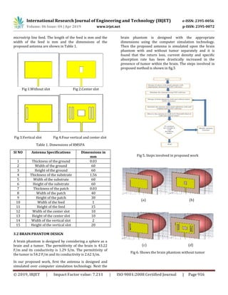 IRJET- Design of a Novel Rectangular Microstrip Patch Antenna for ...