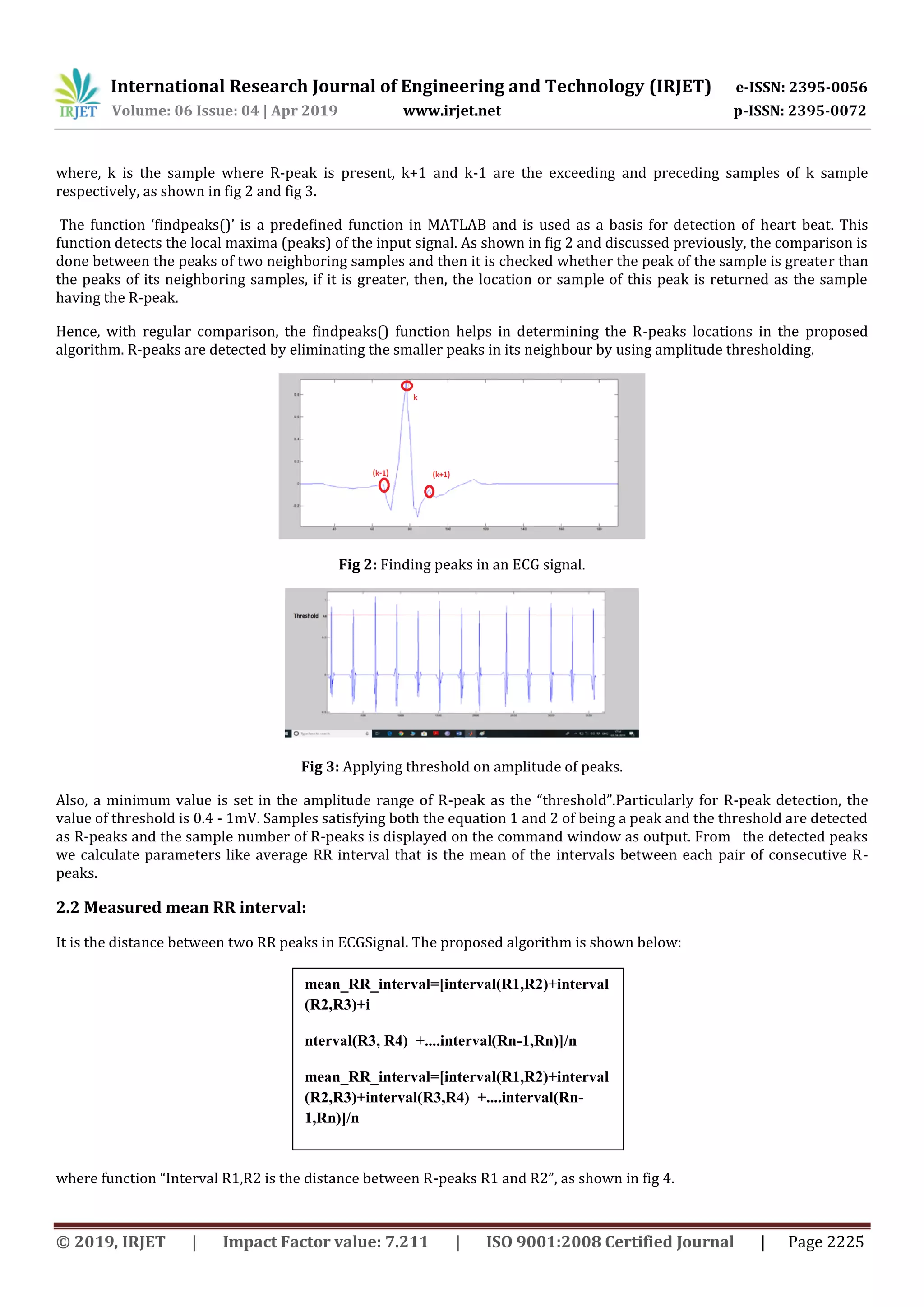 International Research Journal of Engineering and Technology (IRJET) e-ISSN: 2395-0056
Volume: 06 Issue: 04 | Apr 2019 www.irjet.net p-ISSN: 2395-0072
© 2019, IRJET | Impact Factor value: 7.211 | ISO 9001:2008 Certified Journal | Page 2225
where, k is the sample where R-peak is present, k+1 and k-1 are the exceeding and preceding samples of k sample
respectively, as shown in fig 2 and fig 3.
The function ‘findpeaks()’ is a predefined function in MATLAB and is used as a basis for detection of heart beat. This
function detects the local maxima (peaks) of the input signal. As shown in fig 2 and discussed previously, the comparison is
done between the peaks of two neighboring samples and then it is checked whether the peak of the sample is greater than
the peaks of its neighboring samples, if it is greater, then, the location or sample of this peak is returned as the sample
having the R-peak.
Hence, with regular comparison, the findpeaks() function helps in determining the R-peaks locations in the proposed
algorithm. R-peaks are detected by eliminating the smaller peaks in its neighbour by using amplitude thresholding.
Fig 2: Finding peaks in an ECG signal.
Fig 3: Applying threshold on amplitude of peaks.
Also, a minimum value is set in the amplitude range of R-peak as the “threshold”.Particularly for R-peak detection, the
value of threshold is 0.4 - 1mV. Samples satisfying both the equation 1 and 2 of being a peak and the threshold are detected
as R-peaks and the sample number of R-peaks is displayed on the command window as output. From the detected peaks
we calculate parameters like average RR interval that is the mean of the intervals between each pair of consecutive R-
peaks.
2.2 Measured mean RR interval:
It is the distance between two RR peaks in ECGSignal. The proposed algorithm is shown below:
where function “Interval R1,R2 is the distance between R-peaks R1 and R2”, as shown in fig 4.
mean_RR_interval=[interval(R1,R2)+interval
(R2,R3)+i
nterval(R3, R4) +....interval(Rn-1,Rn)]/n
mean_RR_interval=[interval(R1,R2)+interval
(R2,R3)+interval(R3,R4) +....interval(Rn-
1,Rn)]/n
 