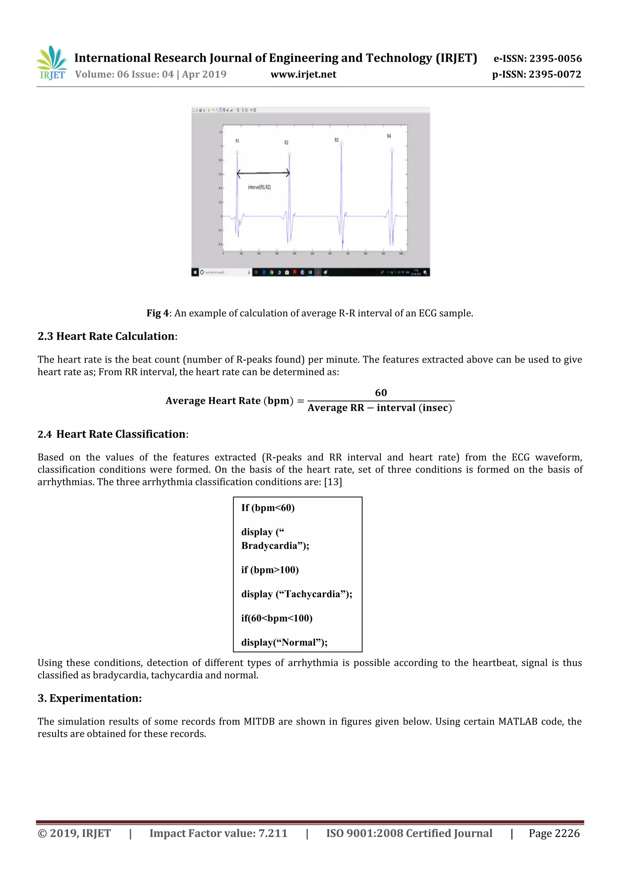 International Research Journal of Engineering and Technology (IRJET) e-ISSN: 2395-0056
Volume: 06 Issue: 04 | Apr 2019 www.irjet.net p-ISSN: 2395-0072
© 2019, IRJET | Impact Factor value: 7.211 | ISO 9001:2008 Certified Journal | Page 2226
Fig 4: An example of calculation of average R-R interval of an ECG sample.
2.3 Heart Rate Calculation:
The heart rate is the beat count (number of R-peaks found) per minute. The features extracted above can be used to give
heart rate as; From RR interval, the heart rate can be determined as:
2.4 Heart Rate Classification:
Based on the values of the features extracted (R-peaks and RR interval and heart rate) from the ECG waveform,
classification conditions were formed. On the basis of the heart rate, set of three conditions is formed on the basis of
arrhythmias. The three arrhythmia classification conditions are: [13]
Using these conditions, detection of different types of arrhythmia is possible according to the heartbeat, signal is thus
classified as bradycardia, tachycardia and normal.
3. Experimentation:
The simulation results of some records from MITDB are shown in figures given below. Using certain MATLAB code, the
results are obtained for these records.
If (bpm<60)
display (“
Bradycardia”);
if (bpm>100)
display (“Tachycardia”);
if(60<bpm<100)
display(“Normal”);
 