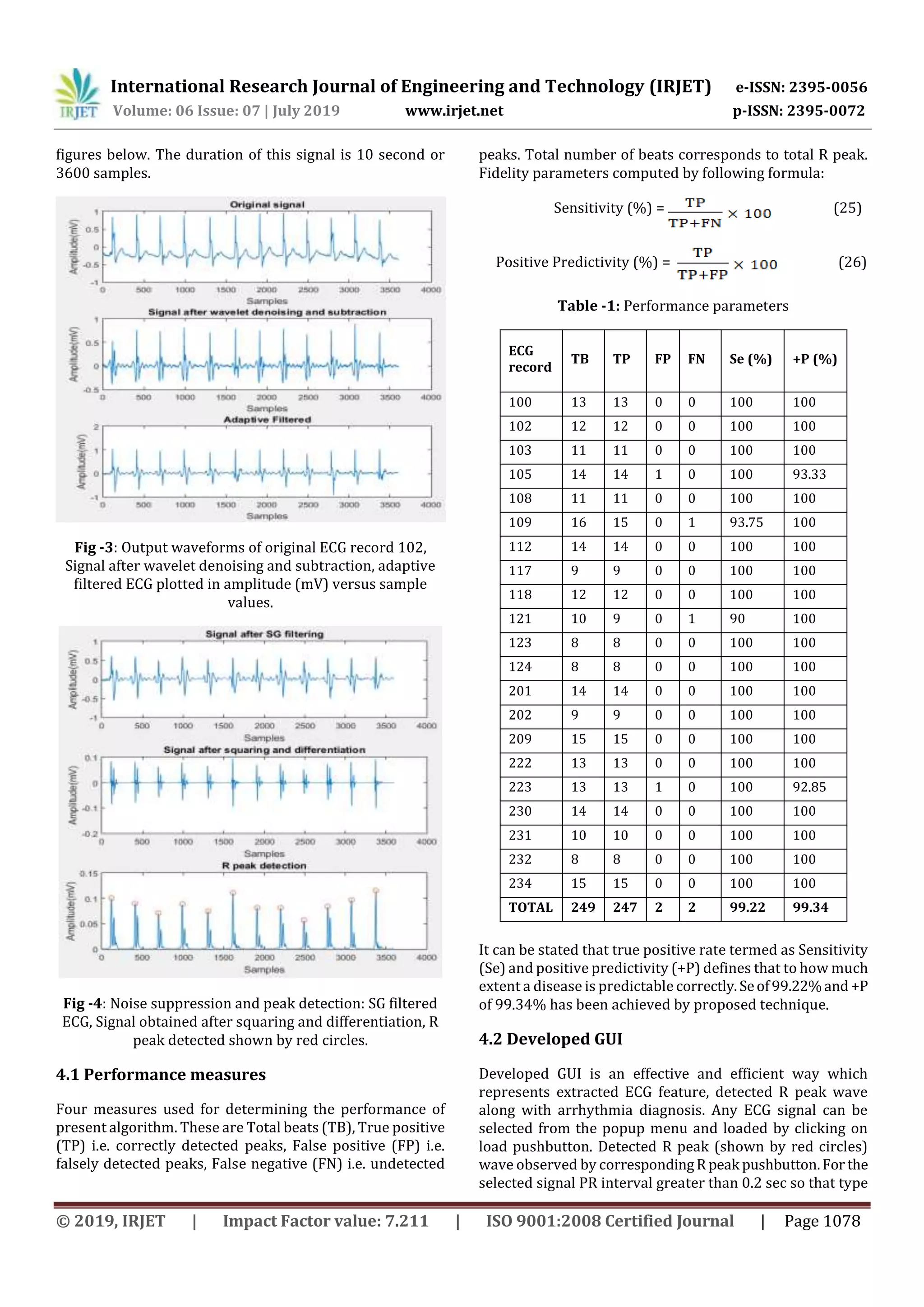 International Research Journal of Engineering and Technology (IRJET) e-ISSN: 2395-0056
Volume: 06 Issue: 07 | July 2019 www.irjet.net p-ISSN: 2395-0072
© 2019, IRJET | Impact Factor value: 7.211 | ISO 9001:2008 Certified Journal | Page 1078
figures below. The duration of this signal is 10 second or
3600 samples.
Fig -3: Output waveforms of original ECG record 102,
Signal after wavelet denoising and subtraction, adaptive
filtered ECG plotted in amplitude (mV) versus sample
values.
Fig -4: Noise suppression and peak detection: SG filtered
ECG, Signal obtained after squaring and differentiation, R
peak detected shown by red circles.
4.1 Performance measures
Four measures used for determining the performance of
present algorithm. These are Total beats (TB), True positive
(TP) i.e. correctly detected peaks, False positive (FP) i.e.
falsely detected peaks, False negative (FN) i.e. undetected
peaks. Total number of beats corresponds to total R peak.
Fidelity parameters computed by following formula:
Sensitivity (%) = (25)
Positive Predictivity (%) = (26)
Table -1: Performance parameters
ECG
record
TB TP FP FN Se (%) +P (%)
100 13 13 0 0 100 100
102 12 12 0 0 100 100
103 11 11 0 0 100 100
105 14 14 1 0 100 93.33
108 11 11 0 0 100 100
109 16 15 0 1 93.75 100
112 14 14 0 0 100 100
117 9 9 0 0 100 100
118 12 12 0 0 100 100
121 10 9 0 1 90 100
123 8 8 0 0 100 100
124 8 8 0 0 100 100
201 14 14 0 0 100 100
202 9 9 0 0 100 100
209 15 15 0 0 100 100
222 13 13 0 0 100 100
223 13 13 1 0 100 92.85
230 14 14 0 0 100 100
231 10 10 0 0 100 100
232 8 8 0 0 100 100
234 15 15 0 0 100 100
TOTAL 249 247 2 2 99.22 99.34
It can be stated that true positive rate termed as Sensitivity
(Se) and positive predictivity (+P) defines that to how much
extent a disease is predictable correctly.Seof99.22%and +P
of 99.34% has been achieved by proposed technique.
4.2 Developed GUI
Developed GUI is an effective and efficient way which
represents extracted ECG feature, detected R peak wave
along with arrhythmia diagnosis. Any ECG signal can be
selected from the popup menu and loaded by clicking on
load pushbutton. Detected R peak (shown by red circles)
wave observed by correspondingRpeak pushbutton.For the
selected signal PR interval greater than 0.2 sec so that type
 