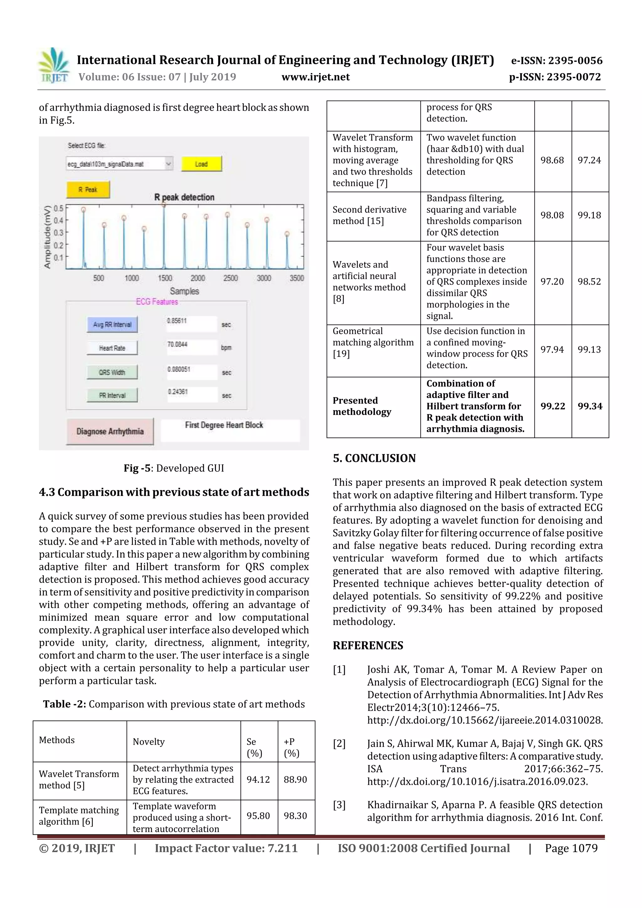 International Research Journal of Engineering and Technology (IRJET) e-ISSN: 2395-0056
Volume: 06 Issue: 07 | July 2019 www.irjet.net p-ISSN: 2395-0072
© 2019, IRJET | Impact Factor value: 7.211 | ISO 9001:2008 Certified Journal | Page 1079
of arrhythmia diagnosed is first degree heartblock asshown
in Fig.5.
Fig -5: Developed GUI
4.3 Comparison with previous state of art methods
A quick survey of some previous studies has been provided
to compare the best performance observed in the present
study. Se and +P are listed in Table with methods, novelty of
particular study. In this paper a newalgorithmbycombining
adaptive filter and Hilbert transform for QRS complex
detection is proposed. This method achieves good accuracy
in term of sensitivity and positive predictivityincomparison
with other competing methods, offering an advantage of
minimized mean square error and low computational
complexity. A graphical user interface also developed which
provide unity, clarity, directness, alignment, integrity,
comfort and charm to the user. The user interface is a single
object with a certain personality to help a particular user
perform a particular task.
Table -2: Comparison with previous state of art methods
Methods Novelty Se
(%)
+P
(%)
Wavelet Transform
method [5]
Detect arrhythmia types
by relating the extracted
ECG features.
94.12 88.90
Template matching
algorithm [6]
Template waveform
produced using a short-
term autocorrelation
95.80 98.30
process for QRS
detection.
Wavelet Transform
with histogram,
moving average
and two thresholds
technique [7]
Two wavelet function
(haar &db10) with dual
thresholding for QRS
detection
98.68 97.24
Second derivative
method [15]
Bandpass filtering,
squaring and variable
thresholds comparison
for QRS detection
98.08 99.18
Wavelets and
artificial neural
networks method
[8]
Four wavelet basis
functions those are
appropriate in detection
of QRS complexes inside
dissimilar QRS
morphologies in the
signal.
97.20 98.52
Geometrical
matching algorithm
[19]
Use decision function in
a confined moving-
window process for QRS
detection.
97.94 99.13
Presented
methodology
Combination of
adaptive filter and
Hilbert transform for
R peak detection with
arrhythmia diagnosis.
99.22 99.34
5. CONCLUSION
This paper presents an improved R peak detection system
that work on adaptive filtering and Hilbert transform. Type
of arrhythmia also diagnosed on the basis of extracted ECG
features. By adopting a wavelet function for denoising and
Savitzky Golay filter for filtering occurrence of false positive
and false negative beats reduced. During recording extra
ventricular waveform formed due to which artifacts
generated that are also removed with adaptive filtering.
Presented technique achieves better-quality detection of
delayed potentials. So sensitivity of 99.22% and positive
predictivity of 99.34% has been attained by proposed
methodology.
REFERENCES
[1] Joshi AK, Tomar A, Tomar M. A Review Paper on
Analysis of Electrocardiograph (ECG) Signal for the
Detection of Arrhythmia Abnormalities.IntJAdvRes
Electr2014;3(10):12466–75.
http://dx.doi.org/10.15662/ijareeie.2014.0310028.
[2] Jain S, Ahirwal MK, Kumar A, Bajaj V, Singh GK. QRS
detection usingadaptivefilters:Acomparativestudy.
ISA Trans 2017;66:362–75.
http://dx.doi.org/10.1016/j.isatra.2016.09.023.
[3] Khadirnaikar S, Aparna P. A feasible QRS detection
algorithm for arrhythmia diagnosis. 2016 Int. Conf.
 