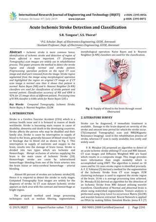International Research Journal of Engineering and Technology (IRJET) e-ISSN: 2395-0056
Volume: 06 Issue: 07 | July 2019 www.irjet.net p-ISSN: 2395-0072
© 2019, IRJET | Impact Factor value: 7.211 | ISO 9001:2008 Certified Journal | Page 2241
Acute Ischemic Stroke Detection and Classification
S.R. Tongase1, S.S. Thorat2
1P.G. Scholar, Dept. of Electronics Engineering, GCOE, Amravati
2Assitant Professor, Dept. of Electronics Engineering, GCOE, Amravati
----------------------------------------------------------------------***---------------------------------------------------------------------
Abstract - Ischemic stroke is more common hence,
identification of ischemic stroke and detection of region of
brain affected is more important. CT (Computed
Tomography) scan images are widely use in rehabilitation
process. This paper presents the method to detect the stroke
region and classify normal and stroke patient.
Preprocessing operation perform on the input CT scan
image and skull part removed from the image. Stroke region
segmented from the image using morphological operation
and highlighted the region on original CT image or if CT
scan image is normal case then it shows that patient is
normal. Naive Bayes (NB) and k- Nearest Neighbor (k-NN)
classifiers are used for classification of stroke patient and
normal patient. Classification accuracy of NB and KNN is
92% for 25 image slices of different patient. Processing time
of K-NN classifier is 8.80s while for Naive Bayes 5.85 s.
Key Words: Computed Tomography, Ischemic Stroke,
Naive Bayes, k- Nearest Neighbor, GLCM
1. INTRODUCTION
Stroke is a Cerebro Vascular Accident (CVA) which is a
serious health issue and it is forward in reason of death
worldwide. Stroke is becoming main reason in cause of
disability, dementia and death in the developing countries.
Stroke affects the person who may be disabled and their
family also. Stroke is cause by interruption in supply of
blood to the brain, generally because of blood vessel burst
or blockage due to blood clot as shown in Fig. 1. This
interruption in supply of nutrients and oxygen to the
brain, results into the damage of brain tissue. Stroke is
divided into two types which are Ischemic and
Hemorrhagic. Abrupt occlusion of arteries supplying the
brain is the main cause of Ischemic Stroke [18].
Hemorrhagic stroke are cause by subarachnoid
hemorrhage- bleeding from one of the brain arteries into
the brain tissue or intra-cerebral hemorrhage - arterial
bleeding.
Almost 80 percent of strokes are ischemic stroke[18].
Hence it is required to detect the stroke in early stages.
Computed Tomography Scan images are widely for the
diagnosis of stroke. In CT scan dataset Ischemic stroke
appears as dark area with the contrast and hemorrhage as
bright region.
The proposed method used image processing
techniques such as median filtering, segmentation,
morphological operation. Naive Bayes and k- Nearest
Neighbor (k-NN) classifiers are used for the classification.
Fig -1: Supply of blood to the brain through vessel
Obstructed
2. LITERATURE SURVEY
Stroke can be diagnosed, if immediate treatment is
available. Damage to the brain depend on severity of the
stroke and amount time period for which the stroke occur.
CT(Computed Tomography) scan and MRI(Magnetic
Resonance Imaging) used in the rehabilitation process of
stroke, whereas CT scan is easily available, less costly and
widely used.
P. R. Mirajkar [4] proposed an algorithm to detect of
an acute ischemic stroke utilizing CT scan and MRI dataset.
CT scan images and Diffusion Weighted MRI are fused
which results in a composite image. This image provides
more information than single modality which is
accomplished using DWT. The algorithm is tested on 18
cases and for 16 cases stroke region is identified precisely.
A. F. Z. Yahiaoui [5] derived a method for the segmentation
of the Ischemic Stroke from CT scan images. FCM
clustering technique is used to segment the stroke region
of the brain. 10.46 s is average processing time achieved.
Dr. Menaka R [6] derived an algorithm for the detection of
an Ischemic Stroke from MRI dataset utilizing wavelet
transform. Classification of Normal and abnormal brain is
attain using watershed segmentation. Texture analysis is
performed using Grey Level Co-occurrence Matrix (GLCM)
and wavelet features extracted. Neural Network is applied
on FPGA by making Xillinx Simulink Blocks. Jeena R S [7]
 