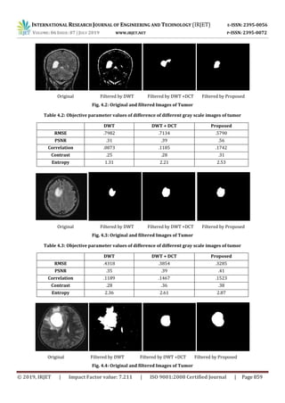 Irjet Design Of Image Resolution Enhancement By Using Dwt And Swt Pdf