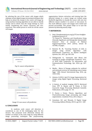 International Research Journal of Engineering and Technology (IRJET) e-ISSN: 2395-0056
Volume: 09 Issue: 10 | Oct 2022 www.irjet.net p-ISSN: 2395-0072
© 2022, IRJET | Impact Factor value: 7.529 | ISO 9001:2008 Certified Journal | Page 98
by selecting the one of the cancer cells images which
undergo certain digital image processing techniques that
help us to detect the clumps in the cancer cell image by
using machine learning algorithm we are able to classify
clumps and to which class the image belongs to, here
mainly considering two classes cancerous and non-
cancerous. This model proves to work for all the cancer
cell images.
Fig 12: cancer cell prediction
Image 13: non cancer cell prediction
6: CONCLUSION
In medicine early cancer cell detection is
considered as one of the challenging tasks for the
doctors. The proposed work effectively detects the
number of clumps at the early stage by using different
image processing techniques like preprocessing,
segmentation, feature extraction and training later the
detected clumps in a cancer image are trained using
ResNet50 algorithm to classify the cancer cells into two
different classes weather it is cancer or non-cancer. In
this work different cancer cell images were tested and
proved successfully. This project helps us to save the
patients by detecting atearly stage.
7: REFERENCES:
1. http://lymphomapictures.org/p/37/non-hodgkin-
lymphoma/picture-37
*2+ Kumar R., “Detection and Classification Using
Clinically Significant and Biologically Interpretable
Features” Proc of Journal of Medical
Engineering,Volume 2015 (2015), Article ID
457906, 14 pages.
2. Rammin M., M., “Counting Number of Cells in
Images using Genetic Algorithm,” 12th
International Conference on Hybrid Intelligent
Systems, Dec. 2017. pp. 185-190.
3. Thillagavathi K., “Automatic Red Blood Cell
Counting in images UsingHough Transform,” Proc.
of 2016 IEEE Conference on Information and
Communication Technology, Apr. 2016, pp. 267-
271.
4. Meello, , Marco A.,“Imaage sedments for artificial
and automatic process for identifying cancer lumps
Eggs,” 30th Annual International Aug. 2016. pp.
3103-3106.
5. Ammon, G.(2012, April 9). Image Segmentation for
images using Digital Signal Processing. Retrieved
from:
6. A history of medical imaging (2017). Retrieved
from: PPT R. Boyyle and R. Vision: A First
Course,On Image Processing Blackwell Scientific
Publications, 2012, page. 32 - 34.
7. E. Davies e Vision: Theory, Algorithms and
Practicalitiesusing Image processing and Image
segmentation , Academic Press, 2011, Chap. 3.
8. Gonzalaez, R.C and Wooods, R Digital Image
Processing, Addison Wesley, 2014 2, pp 414 – 428
 