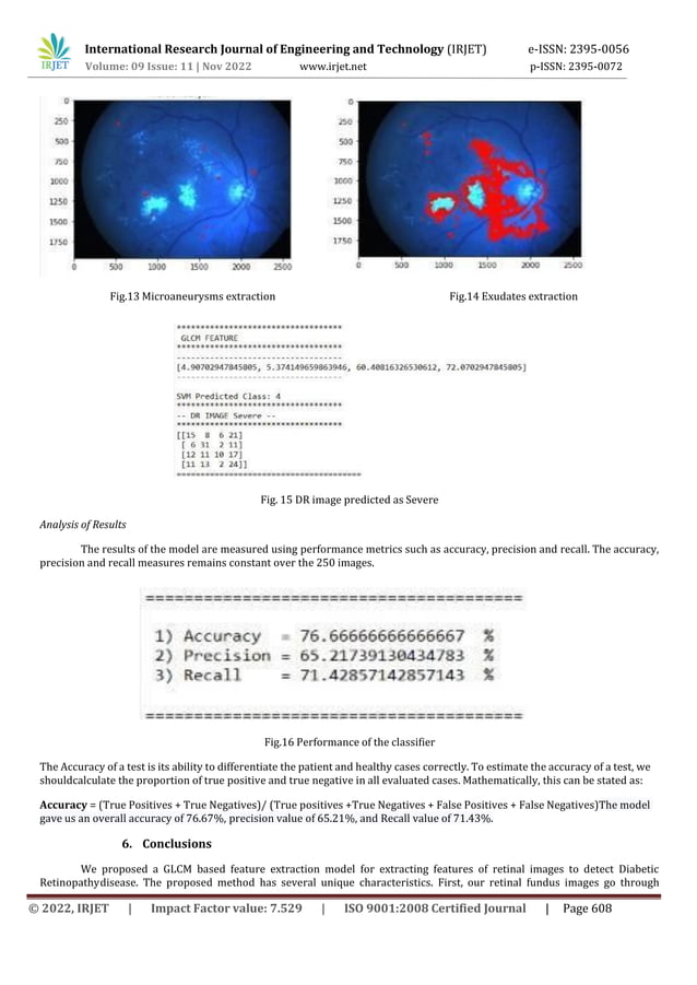 FEATURE EXTRACTION TO DETECT AND CLASSIFY DIABETIC RETINOPATHY USING ...