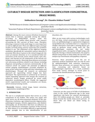 International Research Journal of Engineering and Technology (IRJET) e-ISSN: 2395-0056
Volume: 09 Issue: 01 | Jan 2022 www.irjet.net p-ISSN: 2395-0072
© 2022, IRJET | Impact Factor value: 7.529 | ISO 9001:2008 Certified Journal | Page 1273
CATARACT DISEASE DETECTION AND CLASSIFICATION USINGRETINAL
IMAGE MODEL
Subhashree Sarangi
1
, Dr. Chandra Sekhar Panda
2
1
M.Phil Research Scholar, Department of Computer science and ApplicationsSambalpur University,
Jyotivihar Burla
2
Associate Professor & Head, Department of Computer science andApplications Sambalpur University,
Jyotivihar Burla
-----------------------------------------------------------------***-----------------------------------------------------------------
Abstract- Among the most common blindness hasseveral
causes that is cataract, especially among the elderly.
According to WHO/NPCB surveys, India has
approximately 12 million blind persons, with cataract
accounting for 80.1 percent of those cases. Therefore
detecting a cataract in the early stage is a very important
as well as difficult task. There are different types of image
models currently being used by researchers for problems
related to eye. The utilization of five different imaging
modalities specifically for automated cataract detection is
presented. More focus is given to the retinal images for the
cause of cataract detection as it is considered better for
extraction of the macula, lesion, blood vessels, optic disc,
fovea, and macula are all components of the macula are
all featuresto look for. Detecting these features accurately
can solvemany problems related to eye disease including
diagnosis and grading of cataracts automatically. In this
research article we explore the potential of different
retinal imaging methodologies currently employed by
many of the researchers along with their advantages and
disadvantages. Through the research an automated
approach for segmenting retinal images has been
developed. The segmentation is achieved by an iterative
region expanding approach that merges the contents of
numerous binary images produced by vessel width
dependent morphological filters. Finally, the suggested
work's experimental results and evaluation are shown,
which reveal promising results.
Keywords: Cataract, retinal image, feature extraction,
segmentation, morphological filter
1. INTRODUCTION
The eye is a complicated system that serves as a vital
component of our bodies. The retina, iris, pupil, and
optic nerve are all interconnected elements of the eye.
Glaucoma, trachoma, age-related macular degeneration,
pathological myopia, retinitis pigmentosa, and diabetic
retinopathy are all disorders that have an influence on
the eye. Patientsare sometimes unaware of the severity
of their illness. It is incredibly difficult to appropriately
impair eyesight due to late identification of eye
disorders. [1].
After an eye exam with various technologies such
as a slit lamp, retinal examination, or visual acuity
tests, an ophthalmologist or optometrist diagnoses
eyeproblems [3]. A printed chart or a sequence of
smaller characters read with a viewing device are
used to perform visual acuity tests [3]. The
ophthalmologist examines the eye under
magnification with a strong line of light using a slit
lamp [4]. During a retinal examination, the pupil is
dilated using drops to help widen the eye lens and
analyse eye movements and papillary response.
However, these procedures need the use of
expensive medical equipment that can only be used
by ophthalmologists with extensive experience.
Because these processes are manual, they are both
time- consuming and subjective based on
ophthalmologist experience. As a result, academics
have made various attempts in recent years to
automate the identificationof eye diseases.
Fig 1: Normal eye versus Cataract eye [7]
Cataracts are the cause of 47.8% of all blindness
cases in the world. Advanced age is the most
significant risk factor for cataract development.
Over 314 million people are blind or partially
blind around the world. Sixty-seven percent of
those who are blind are blind owing to
cataracts.
 