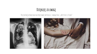 Dziękuję za uwagę
Prezentacja powstała na podstawie artykułu z magazynu ,,Artysta i sztuka’’
 