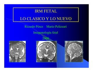 IRM FETAL
LO CLASICO Y LO NUEVO
 Ricardo Pérez Mario Pelizzari
      Imagenología fetal
             2009
 