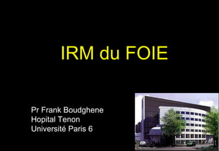 IRM du FOIE
Pr Frank Boudghene
Hopital Tenon
Université Paris 6
 