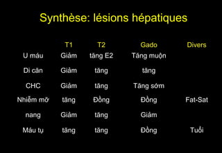 Synthèse: lésions hépatiques
T1 T2 Gado Divers
U máu Giảm tăng E2 Tăng muộn
Di căn Giảm tăng tăng
CHC Giảm tăng Tăng sớm
Nhiễm mỡ tăng Đồng Đồng Fat-Sat
nang Giảm tăng Giảm
Máu tụ tăng tăng Đồng Tuổi
 