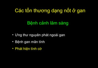 Các tổn thương dạng nốt ở gan
Bệnh cảnh lâm sàng
• Ưng thư nguyên phát ngoài gan
• Bệnh gan mãn tính
• Phát hiện tình cờ
 