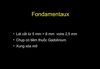 Fondamentaux
• Lát cắt từ 5 mm > 8 mm voire 2,5 mm
• Chụp có tiêm thuốc Gadolinium
• Xung xóa mỡ
 