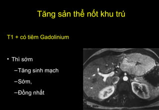 T1 + có tiêm Gadolinium
• Thì sớm
–Tăng sinh mạch
–Sớm,
–Đồng nhất
Tăng sản thể nốt khu trú
 