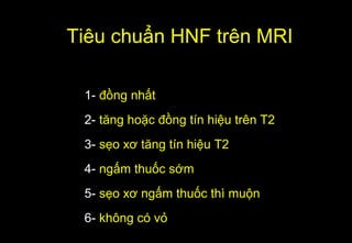 1- đồng nhất
2- tăng hoặc đồng tín hiệu trên T2
3- sẹo xơ tăng tín hiệu T2
4- ngấm thuốc sớm
5- sẹo xơ ngấm thuốc thì muộn
6- không có vỏ
Tiêu chuẩn HNF trên MRI
 