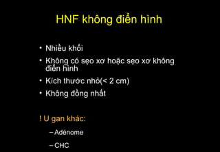 HNF không điển hình
• Nhiều khối
• Không có sẹo xơ hoặc sẹo xơ không
điển hình
• Kích thước nhỏ(< 2 cm)
• Không đồng nhất
! U gan khác:
– Adénome
– CHC
 