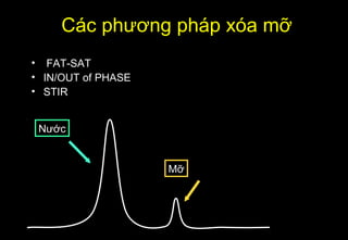 Nước
Mỡ
Các phương pháp xóa mỡ
• FAT-SAT
• IN/OUT of PHASE
• STIR
 