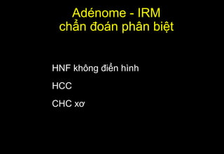 Adénome - IRM
chẩn đoán phân biệt
HNF không điển hình
HCC
CHC xơ
 