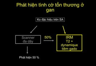 Phát hiện tình cờ tổn thương ở
gan
Scanner
đa dãy
Ko đặc hiệu trên SA
IRM
T2 +
dynamique
tiêm gado
Phát hiện 50 %
50%
 