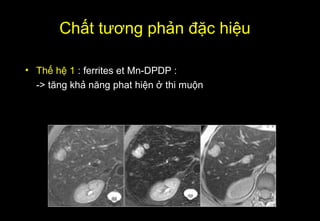 Chất tương phản đặc hiệu
• Thế hệ 1 : ferrites et Mn-DPDP :
-> tăng khả năng phat hiện ở thi muộn
 