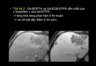 • Thế hệ 2 : Gd-BOPTA và Gd-EOB-DTPA dẫn chất của
« lipophiles » của Gd-DTPA :
-> tăng khả năng phat hiện ở thi muộn
-> và nổi bật đặc điểm ở thì sớm.
 