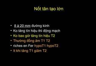 • 8 à 20 mm đường kính
• Ko tăng tín hiệu thì động mạch
• Ko bao giờ tăng tín hiệu T2
• Thường đồng âm T1 T2
• riches en Fer hypoT1 hypoT2
• It khi tăng T1 giảm T2
Nốt tân tạo lớn
 