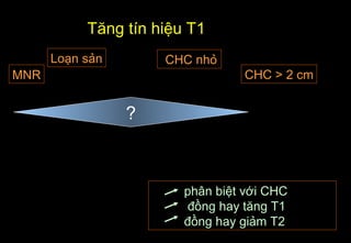 CHC nhỏ
CHC > 2 cmMNR
Loạn sản
Tăng tín hiệu T1
?
phân biệt với CHC
đồng hay tăng T1
đồng hay giảm T2
 