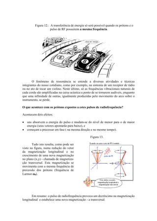 Figura 12.: A transferência de energia só será possível quando os prótons e o
pulso de RF possuírem a mesma frequência.
O fenômeno de ressonância se estende a diversas atividades e técnicas
integrantes do nosso cotidiano, como por exemplo, na sintonia de um receptor de rádio
ou no ato de tocar um violino. Neste último, só as frequências vibracionais naturais de
cada corda são amplificadas na caixa acústica a ponto de se tornarem audíveis, enquanto
que uma infinidade de outras, igualmente produzidas pelo movimento do arco sobre o
instrumento, se perde.
O que acontece com os prótons expostos a estes pulsos de radiofrequência?
Acontecem dois efeitos:
• uns absorvem a energia do pulso e mudam-se do nível de menor para o de maior
energia (seus vetores apontarão para baixo), e
• começam a precessar em fase ( na mesma direção e no mesmo tempo).
Tudo isto resulta, como pode ser
visto na figura, numa redução do vetor
da magnetização longitudinal e no
crescimento de uma nova magnetização
no plano (x,y) - chamada de magnetiza-
ção transversal. Esta magnetização se
movimenta com a mesma frequência de
precessão dos prótons (frequência de
Larmor ω0).
Figura 13.
Em resumo: o pulso de radiofrequência provoca um decréscimo na magnetização
longitudinal e estabelece uma nova magnetização - a transversal.
 